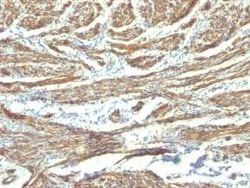Caldesmon/CALD1 Antibody (CALD1/820 + h-CALD), Novus Biologicals 0.02mg;