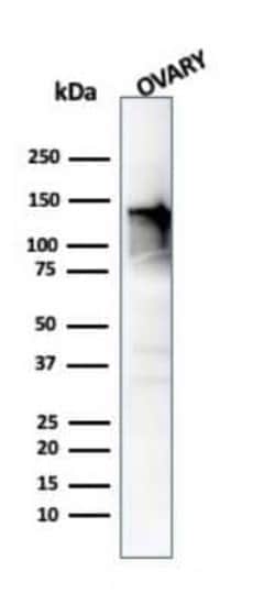 Caldesmon/CALD1 Antibody (CALD1/820), Novus Biologicals:Antibodies:Primary