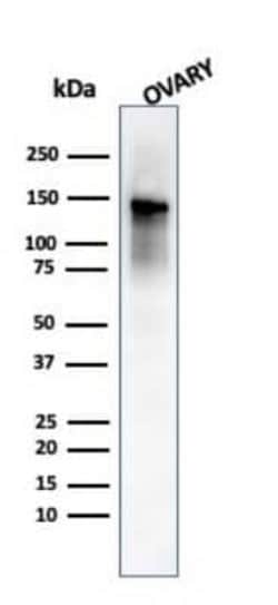 Caldesmon/CALD1 Antibody (SPM168), Novus Biologicals 0.1mg; Unlabeled:Antibodies,