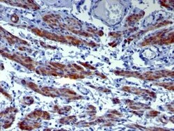 Caldesmon/CALD1 Antibody (h-CALD), Novus Biologicals 0.02mg; Unlabeled:Antibodies,
