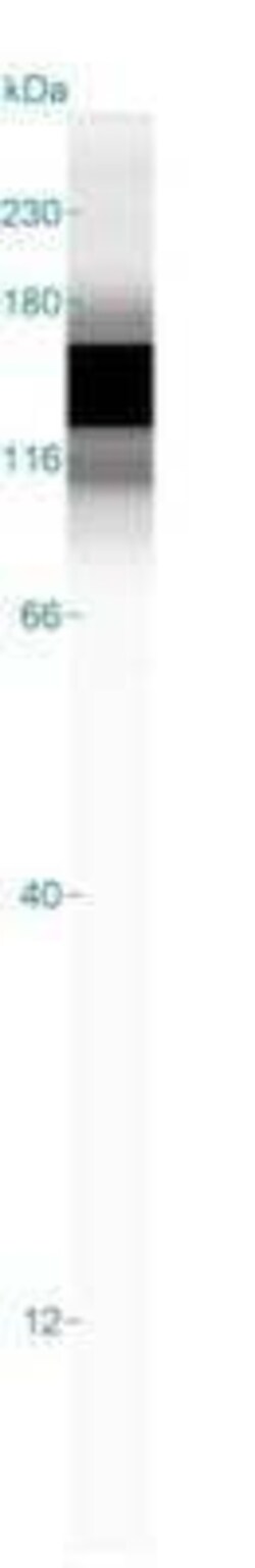 Caldesmon/CALD1 Antibody (h-CALD), Novus Biologicals 0.02mg; Unlabeled:Antibodies,