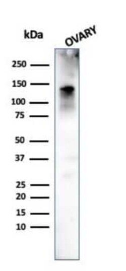 Caldesmon/CALD1 Antibody (h-CALD), Novus Biologicals 0.02mg; Unlabeled:Antibodies,
