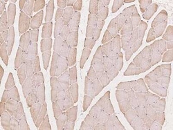 Calpain 3 Antibody, Novus Biologicals:Antibodies:Primary Antibodies