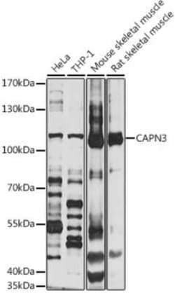 Calpain 3 Antibody - BSA Free, Novus Biologicals 0.02 mL, Unconjugated:Anticorps,