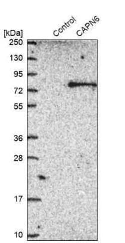 Calpain 6 Antibody, Novus Biologicals 0.1 mL; Unconjugated:Antibodies,