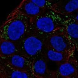 Calpain 9 Rabbit anti-Human, Polyclonal, Novus Biologicals 100 &mu;g | Buy Online | Novus Biologicals | Fisher Scientific