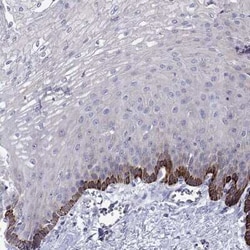 Calpain S2 Antibody, Novus Biologicals:Antibodies:Primary Antibodies