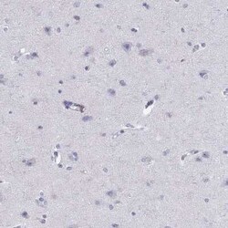 Calpain S2 Antibody, Novus Biologicals:Antibodies:Primary Antibodies