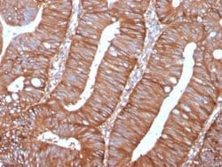 Calpastatin Mouse anti-Human, Clone: CAST/1550, Novus Biologicals 20 &mu;g;