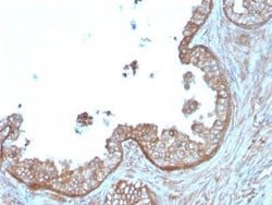 Calpastatin Mouse anti-Human, Clone: CAST/1550, Novus Biologicals 20 &mu;g;
