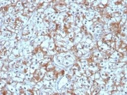 Calpastatin Mouse anti-Human, Clone: CAST/1550, Novus Biologicals 20 &mu;g;