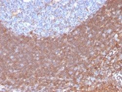 Calpastatin Mouse anti-Human, Clone: CAST/1550, Novus Biologicals 20 &mu;g;