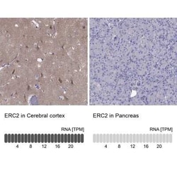 ERC2 Antibody, Novus Biologicals:Antibodies:Primary Antibodies