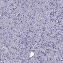 ERC2 Antibody, Novus Biologicals:Antibodies:Primary Antibodies