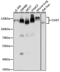 Calpastatin Antibody - BSA Free, Novus Biologicals:Antibodies:Primary Antibodies