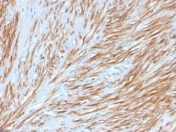 Calponin 1 Rabbit anti-Human, Clone: CNN1/4227R, Novus Biologicals:Antibodies:Primary