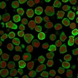 Calponin 1 Antibody (CALP), Novus Biologicals 0.1mg; Unlabeled:Antibodies,