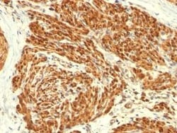 Calponin 1 Antibody (CALP), Novus Biologicals 0.1mg; Unlabeled:Antibodies,