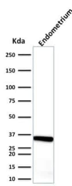 Calponin 1 Antibody (CALP), Novus Biologicals 0.1mg; Unlabeled:Antibodies,
