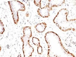 Calponin 1 Antibody (CNN1/832), Novus Biologicals:Antibodies:Primary Antibodies