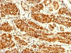 Calponin 1 Antibody (CNN1/832), Novus Biologicals:Antibodies:Primary Antibodies