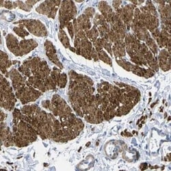 Calponin 1 Antibody, Novus Biologicals 25 &mu;L; Unconjugated:Antibodies,