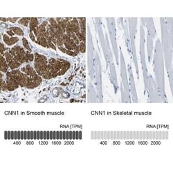 Calponin 1 Antibody, Novus Biologicals 25 &mu;L; Unconjugated:Antibodies,