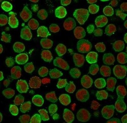 Calponin 1 Antibody (SPM169), Novus Biologicals:Antibodies:Primary Antibodies