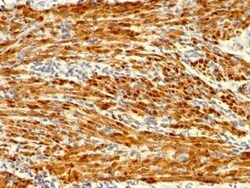 Calponin 1 Antibody (SPM169), Novus Biologicals:Antibodies:Primary Antibodies