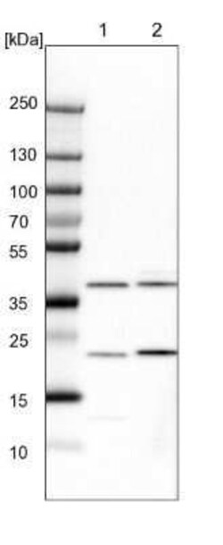 Calponin 1 Antibody, Novus Biologicals 25 &mu;L; Unconjugated:Antibodies,