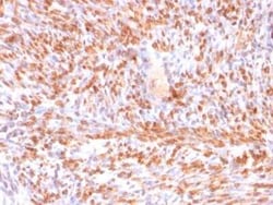 Calponin 1 Antibody (rCNN1/832), Novus Biologicals:Antibodies:Primary Antibodies
