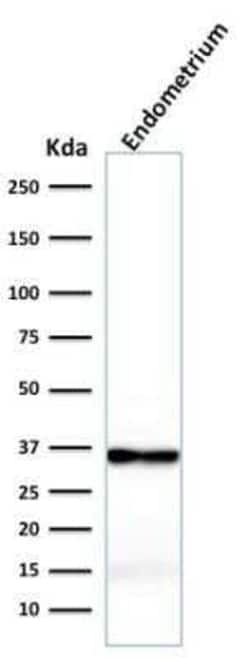 Calponin 1 Antibody (rCNN1/832), Novus Biologicals:Antibodies:Primary Antibodies