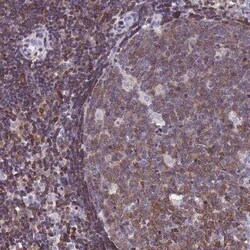 Calponin 2 Antibody, Novus Biologicals 0.1 mL | Buy Online | Novus Biologicals | Fisher Scientific