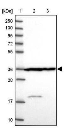 Calponin 2 Antibody, Novus Biologicals 0.1 mL | Buy Online | Novus Biologicals | Fisher Scientific