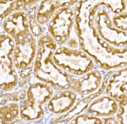 Calreticulin Rabbit anti-Human, Mouse, Rat, Clone: ARC0632, Novus Biologicals