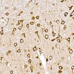 Calreticulin Rabbit anti-Human, Mouse, Rat, Clone: ARC0632, Novus Biologicals