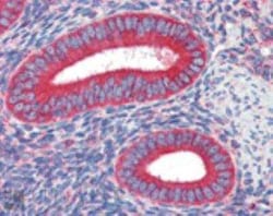 Calreticulin Antibody (FMC 75), Novus Biologicals 0.2mg; Unlabeled:Antibodies,