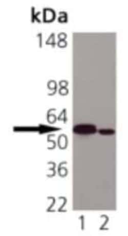 Calreticulin Antibody (FMC 75), Novus Biologicals 0.2mg; Unlabeled:Antibodies,