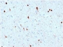 Calretinin Mouse anti-Human, Clone: CALB2/2602, Novus Biologicals:Anticorps:Anticorps