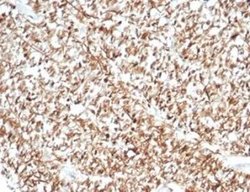 Calretinin Rabbit anti-Human, Clone: CALB2/7029R, Novus Biologicals:Antibodies:Primary
