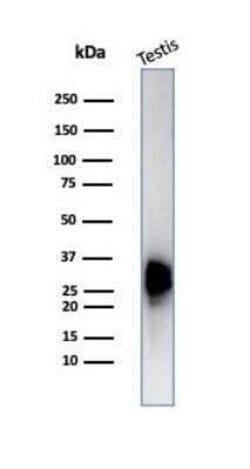 Calretinin Rabbit anti-Human, Clone: CALB2/7029R, Novus Biologicals:Antibodies:Primary