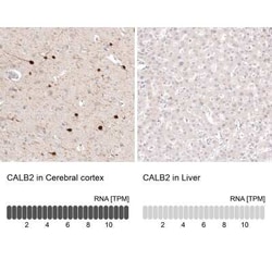 Calretinin Antibody (CL12838), Novus Biologicals 100 &mu;g; Unconjugated:Antibodies,