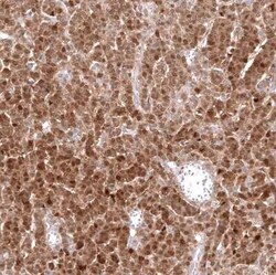 Calretinin Antibody (CL12838), Novus Biologicals 100 &mu;g; Unconjugated:Antibodies,