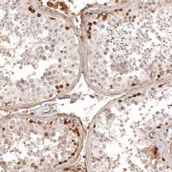 Calretinin Antibody (CL12838), Novus Biologicals 100 &mu;g; Unconjugated:Antibodies,