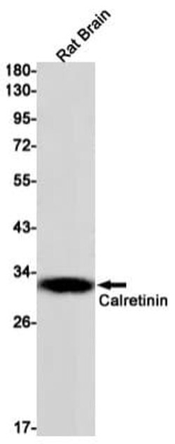 Calretinin Antibody (S01-2G7), Novus Biologicals 50 &mu;g; Unconjugated:Antibodies,