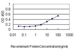 Calsequestrin 2 Antibody (1B6), Novus Biologicals 0.1 mg, Unconjugated:Antibodies,