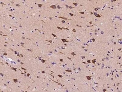 Calsyntenin-1 Antibody, Novus Biologicals:Antibodies:Primary Antibodies