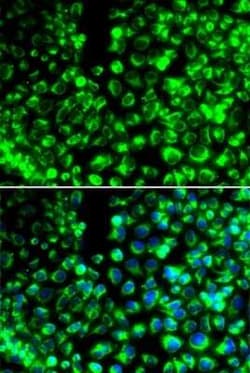 Calumenin Antibody - BSA Free, Novus Biologicals 0.1 mL, Unconjugated:Antibodies,