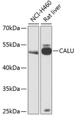 Calumenin Antibody - BSA Free, Novus Biologicals 0.1 mL, Unconjugated:Antibodies,