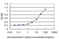 Cannabinoid R1/CB1/CNR1 Antibody (2F9), Novus Biologicals 0.1 mg, Unconjugated:Antibodies,